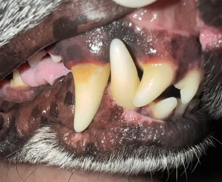 Whiter Teeth